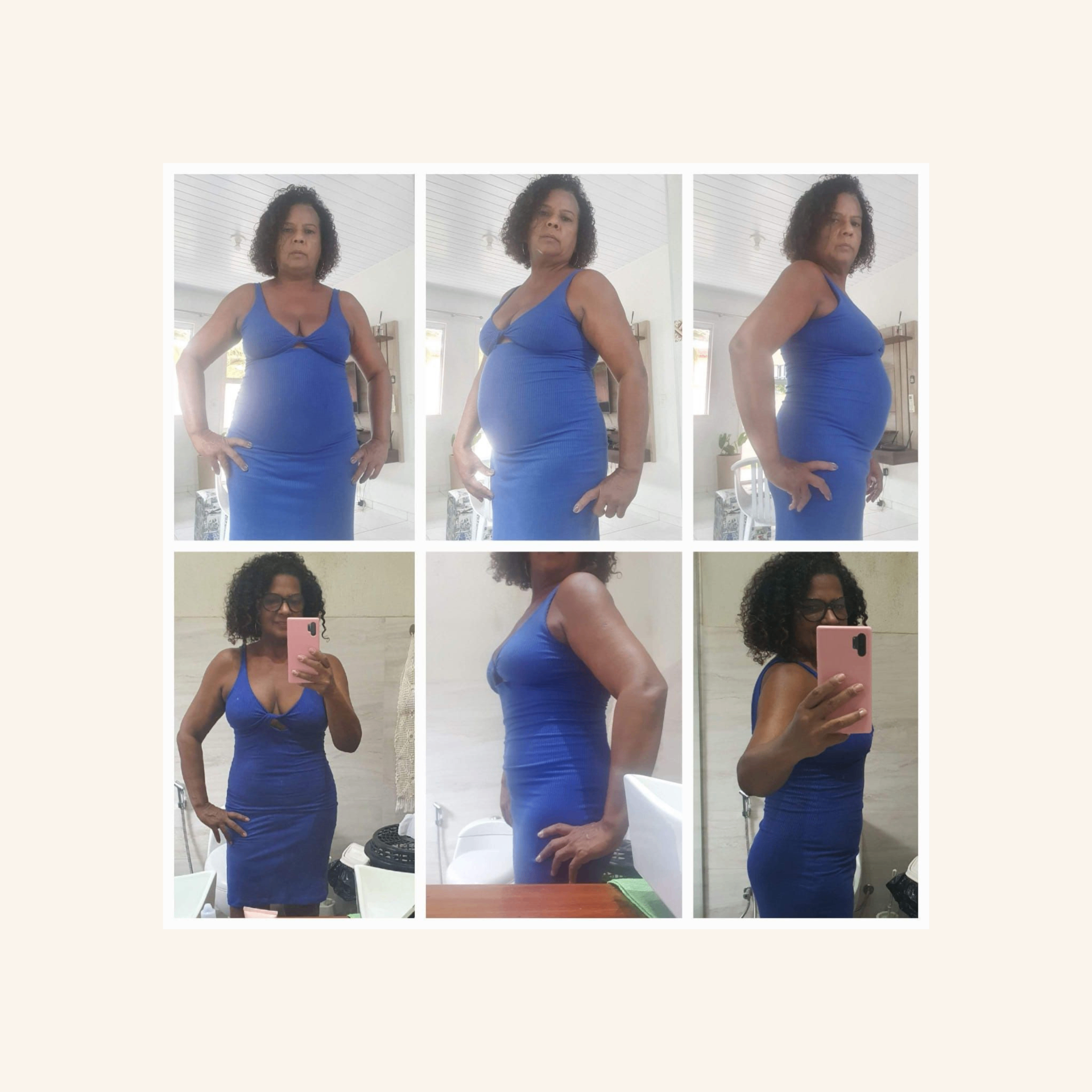 Depoimento 5 — antes e depois