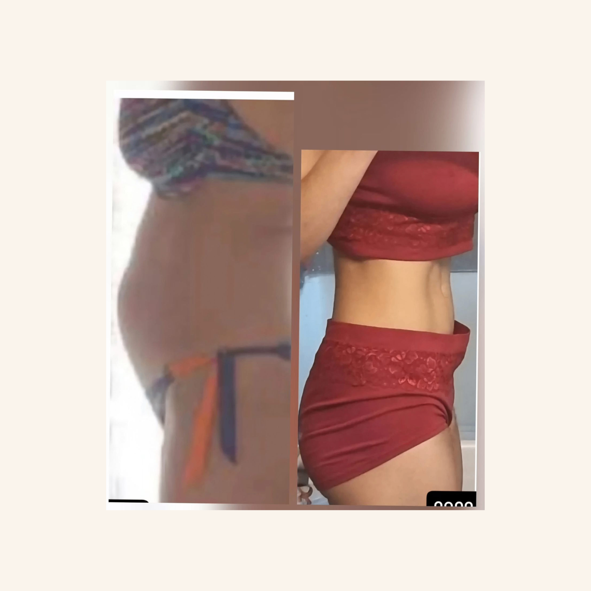 Depoimento 3 — antes e depois