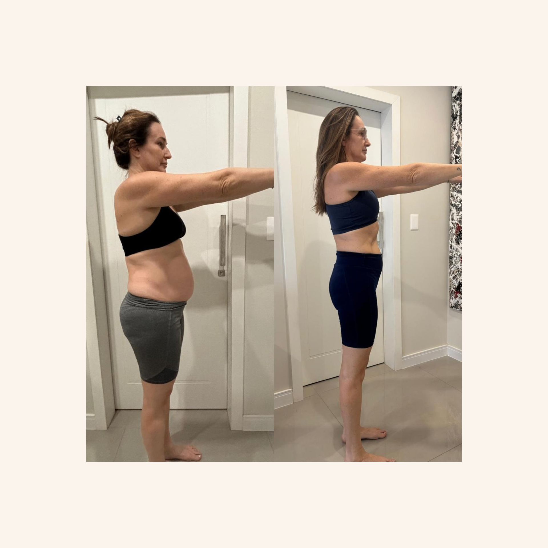 Depoimento 4 — antes e depois